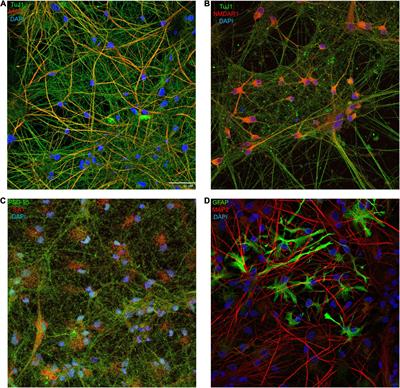 Robust Expression of Functional NMDA Receptors in Human Induced Pluripotent Stem Cell-Derived Neuronal Cultures Using an Accelerated Protocol